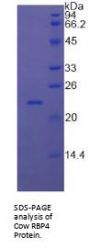 Cow Retinol Binding Protein 4, Plasma (RBP4) Protein