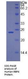 Human Retinol Binding Protein 4, Plasma (RBP4) Protein