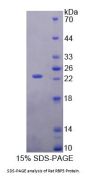 Rat Retinol Binding Protein 5, Cellular (RBP5) Protein
