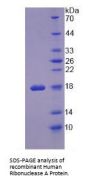 Human Ribonuclease A (RNASE1) Protein