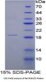 Rat Eosinophil Cationic Protein / ECP (RNASE3) Protein