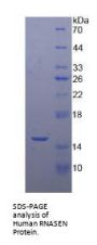 Human Ribonuclease III, Nuclear (RNASEN) Protein