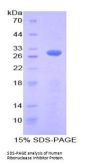 Human Ribonuclease Inhibitor (RI) Protein