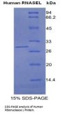 Human Ribonuclease L (RNASEL) Protein