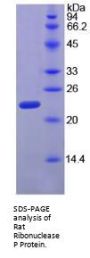 Rat Ribonuclease P subunit 40 (RPP40) Protein (RPP40) Protein