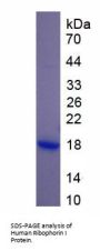 Human Ribophorin I (RPN1) Protein