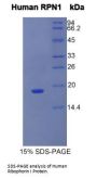Human Ribophorin I (RPN1) Protein