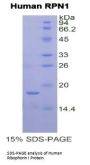 Human Ribophorin I (RPN1) Protein