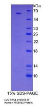 Human Ribosomal Protein S6 Kinase Beta 2 (RPS6Kb2) Protein