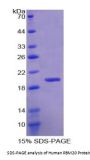 Human RNA Binding Motif Protein 20 (RBM20) Protein