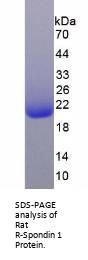 Rat R-Spondin 1 (RSPO1) Protein