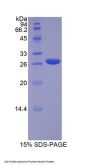 Human Runt Related Transcription Factor 2 (RUNX2) Protein