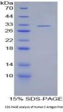 Human S Antigen (SAG) Protein