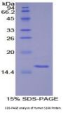 Human S100 Calcium Binding Protein (S100) Protein