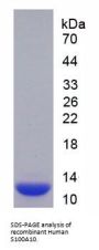 Human S100 Calcium Binding Protein A10 (S100A10) Protein