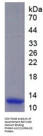 Rat S100 Calcium Binding Protein A10 (S100A10) Protein