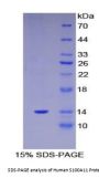 Human S100 Calcium Binding Protein A11 (S100A11) Protein