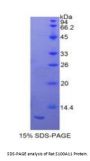 Rat S100 Calcium Binding Protein A11 (S100A11) Protein