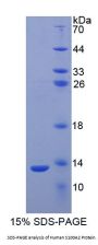 Human S100 Calcium Binding Protein A2 (S100A2) Protein