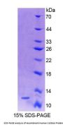 Human S100 Calcium Binding Protein A4 (S100A4) Protein