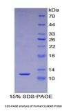 Human S100 Calcium Binding Protein A5 (S100A5) Protein
