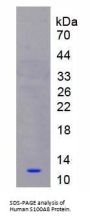 Human Protein S100-A8 / CAGA (S100A8) Protein