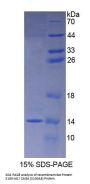 Rat Protein S100-A8 / CAGA (S100A8) Protein