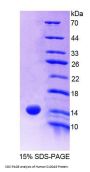 Human Protein S100-A9 / CAGB (S100A9) Protein