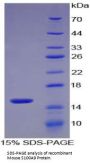 Mouse Protein S100-A9 / CAGB (S100A9) Protein