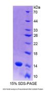Rat Protein S100-A9 / CAGB (S100A9) Protein