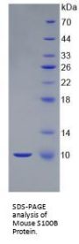 Mouse S100 Calcium Binding Protein B (S100B) Protein