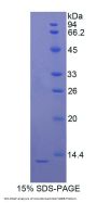 Rat S100 Calcium Binding Protein B (S100B) Protein