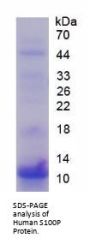 Human S100 Calcium Binding Protein P (S100P) Protein