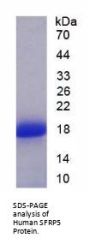 Human Secreted Frizzled Related Protein 5 (SFRP5) Protein