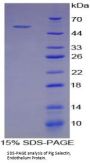 Pig E-Selectin / CD62E (SELE) Protein
