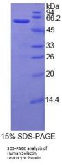 Human L-Selectin / CD62L (SELL) Protein