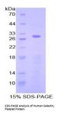 Human P-Selectin (SELP) Protein