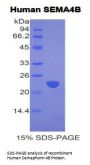 Human Semaphorin 4B (SEMA4B) Protein