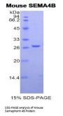 Mouse Semaphorin 4B (SEMA4B) Protein