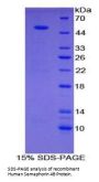 Human Semaphorin 4B (SEMA4B) Protein