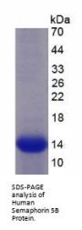 Human Semaphorin 5B (SEMA5B) Protein