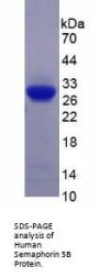 Human Semaphorin 5B (SEMA5B) Protein