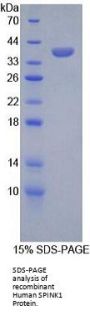 Human Serine Peptidase Inhibitor Kazal Type 1 (SPINK1) Protein