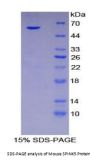 Mouse Serine Peptidase Inhibitor Kazal Type 5 (SPINK5) Protein