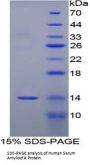 Human Serum Amyloid A Protein (SAA1) Protein