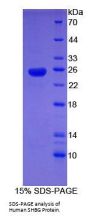 Human Sex Hormone Binding Globulin (SHBG) Protein