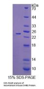 Mouse Sex Hormone Binding Globulin (SHBG) Protein