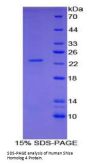 Human Shisa Homolog 4 (SHISA4) Protein