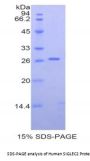Human Sialic Acid Binding Ig Like Lectin 2 (SIGLEC2) Protein