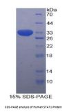 Human Signal Transducer And Activator Of Transcription 1 (STAT1) Protein
